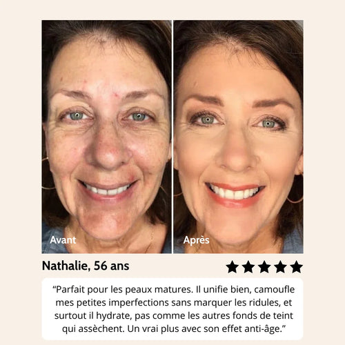 Fond de teint Miryom®