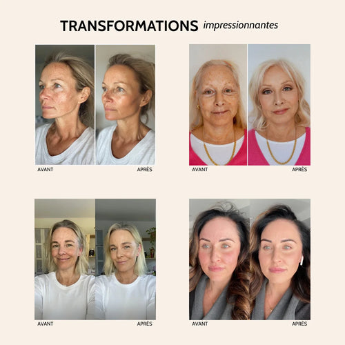 Fond de teint Miryom®